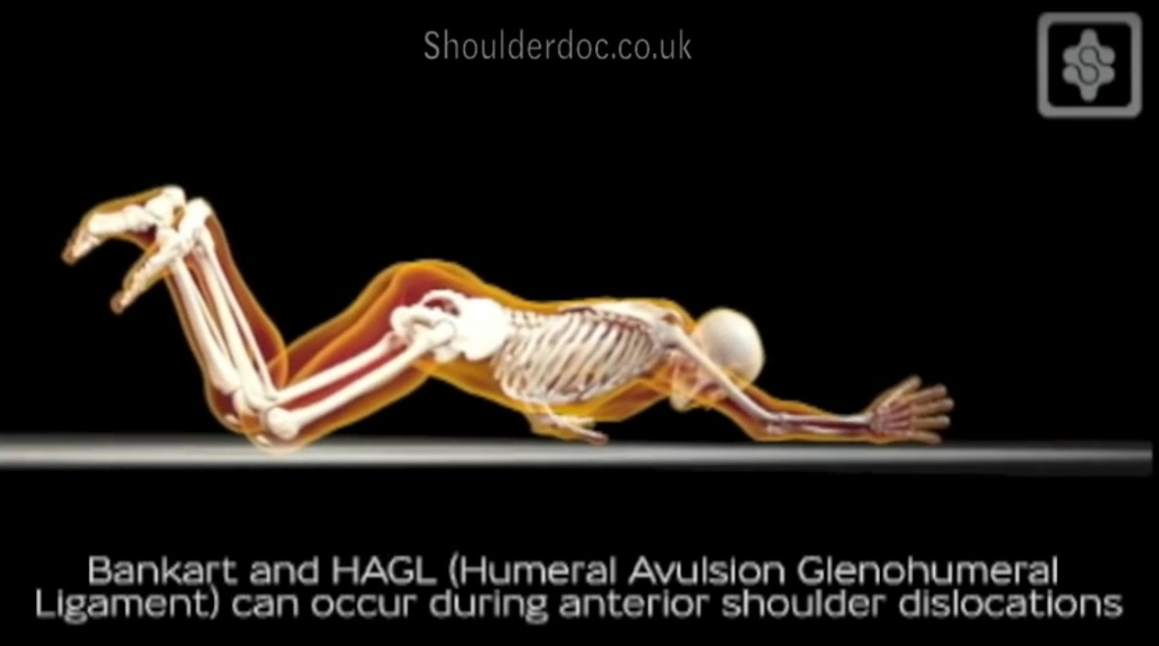 Shoulder Dislocation Animation and Surgical Repair